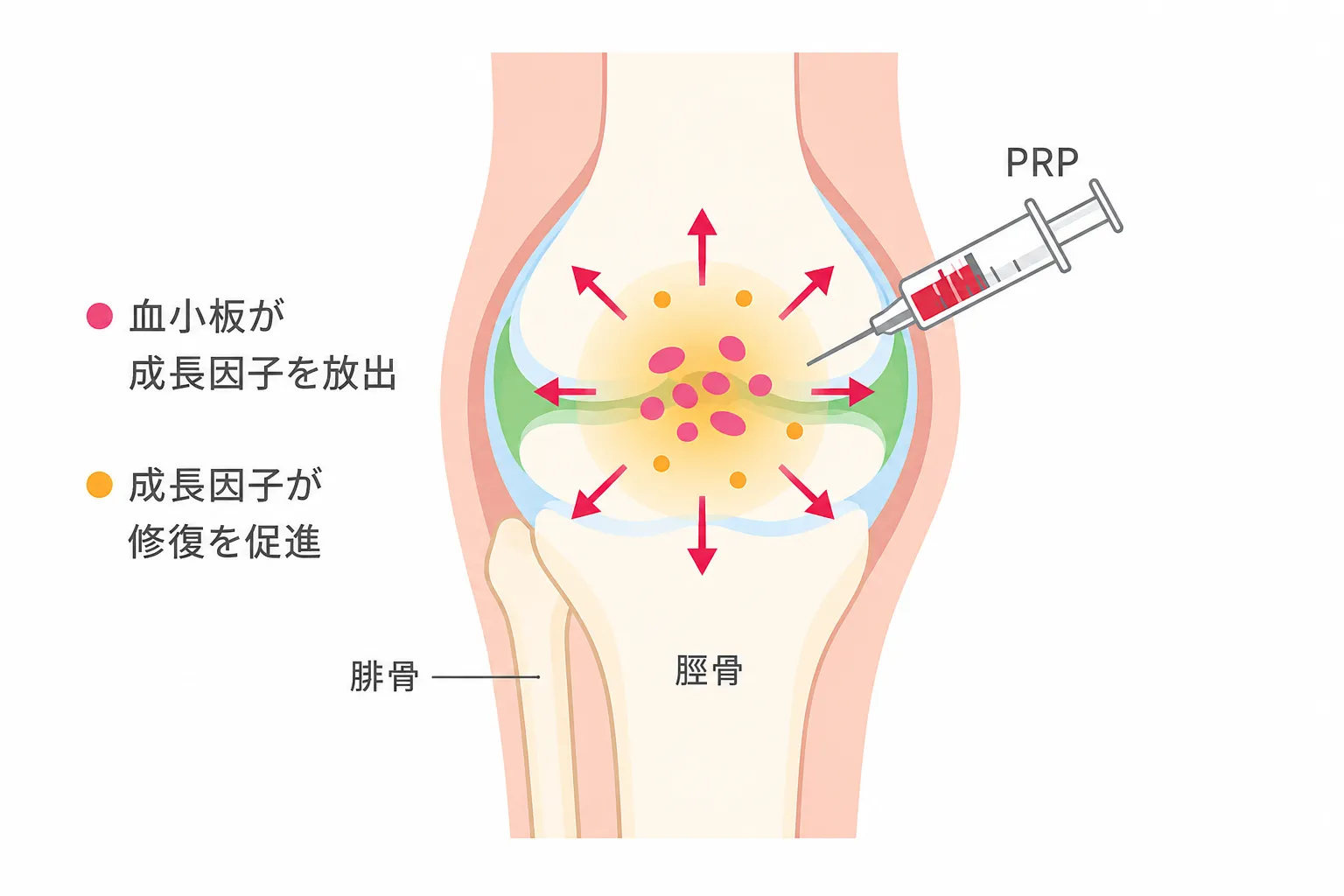 PRP療法